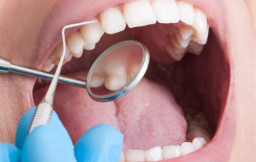 Лечение зубов методики проведения лечебных процедур
