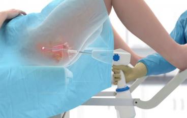 Лазерные процедуры в гинекологии